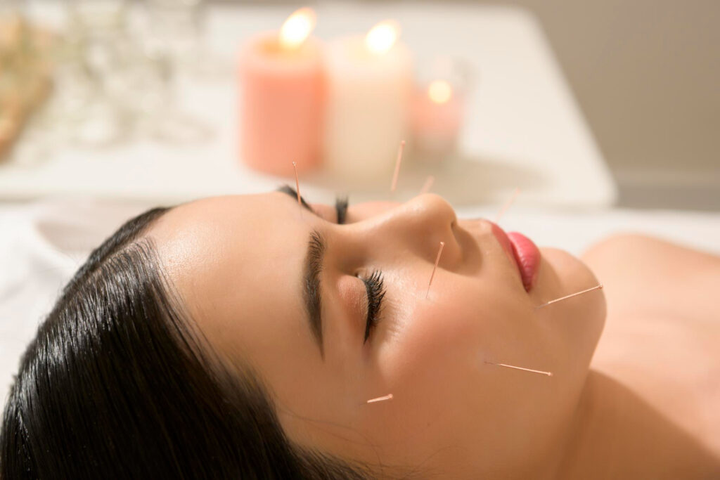 acupuntura facial