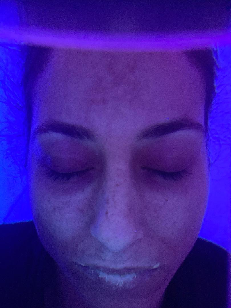 imagen de una cara examinada con luz led